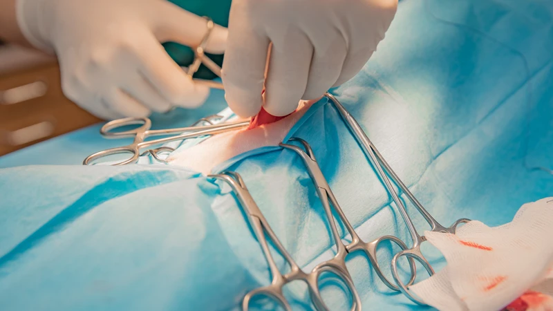 Phương pháp này giúp kiểm soát tốt cơn đau sau phẫu thuật, đặc biệt là các phẫu thuật vùng bụng, sản phụ khoa
