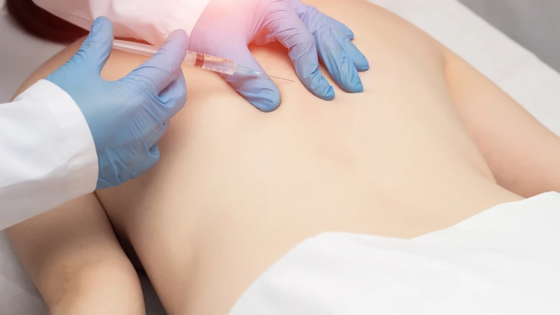 Gây tê cục bộ được đánh giá là phương pháp an toàn và được sử dụng phổ biến