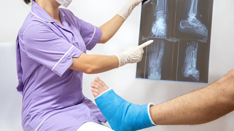 X-quang cho phép quan sát hình ảnh cấu trúc xương, phát hiện các đường gãy rõ ràng, định vị vị trí tổn thương và đánh giá mức độ lệch trục nếu có