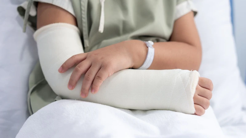 Gãy xương cẳng tay bao lâu thì lành còn phụ thuộc vào nhiều yếu tố nhưng thông thường mất khoảng từ 6 - 12 tuần