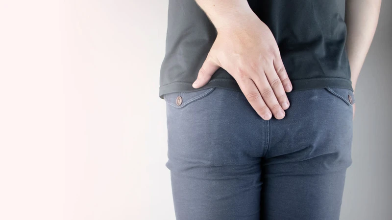 Ghẻ ở mông là một dạng nhiễm ký sinh trùng da liễu do Sarcoptes scabiei hominis gây ra