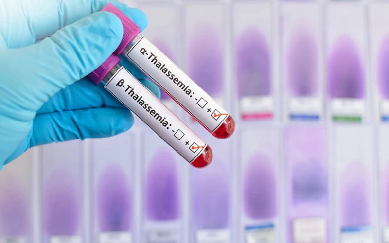 Ghép tủy có thể được chỉ định trong điều trị bệnh thalassemia, giúp cải thiện tình trạng bệnh