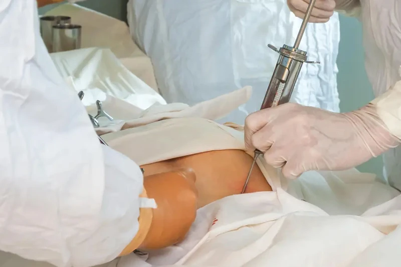 Ghép tủy là phương pháp đưa tế bào gốc khỏe mạnh vào cơ thể người để thay thế các tế bào gốc bị tổn thương