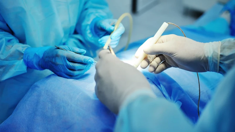 Một số thủ thuật và phẫu thuật có thể gây tổn thương động mạch và hình thành túi giả phình