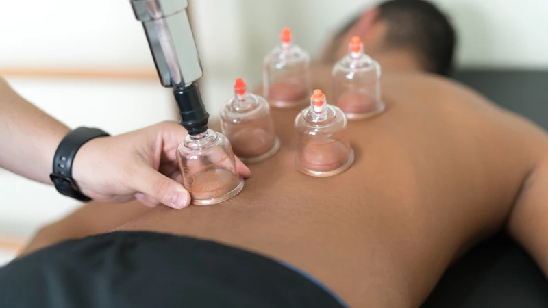Giác hơi có tác dụng sơ kinh thông lạc, khai thông các đường kinh mạch