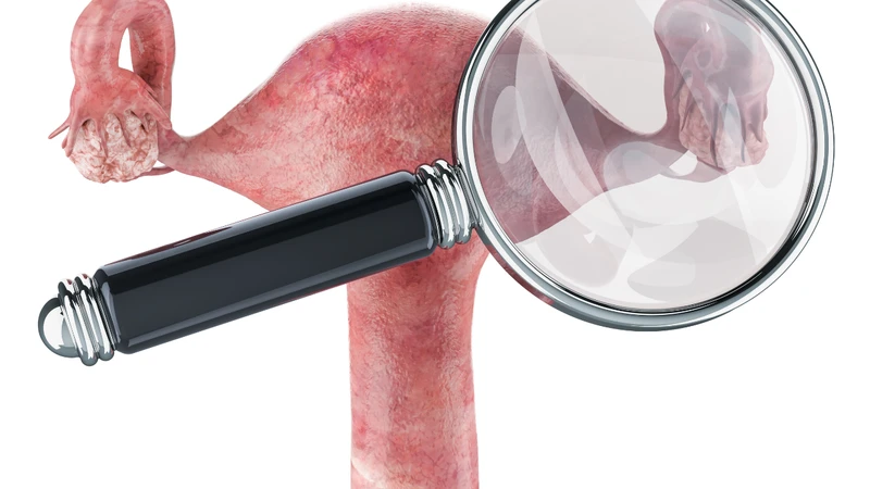 Ảnh hưởng của hormone Estrogen cũng được cho là có vai trò trong quá trình giãn tĩnh mạch vùng chậu