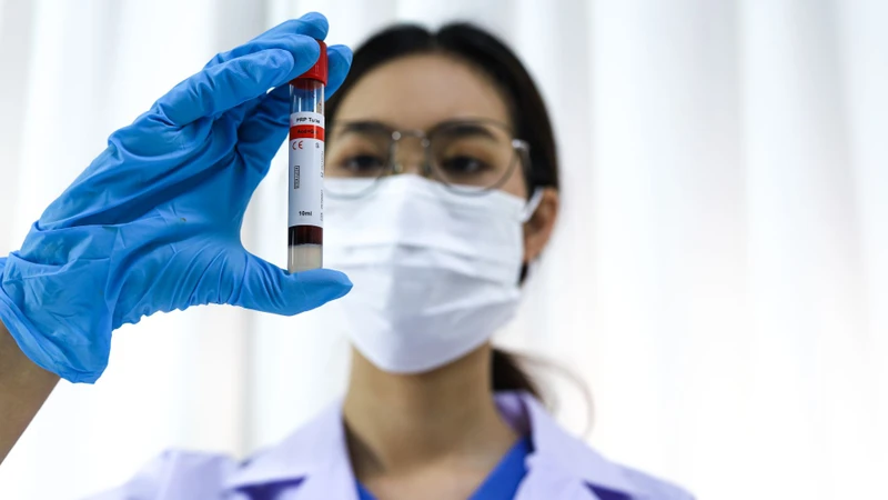 Bác sĩ có thể chỉ định xét nghiệm máu để chẩn đoán nhiễm giun móc