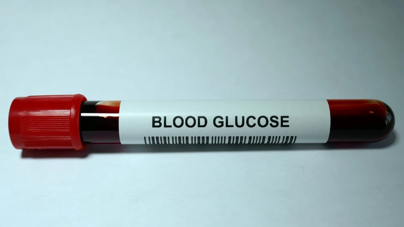 Glucose trong xét nghiệm máu là gì hiểu đúng để theo dõi sức khỏe