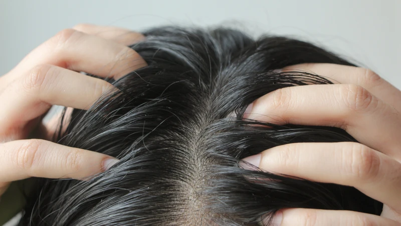 Gội đầu quá nhiều có thể khiến da đầu khô và dễ kích ứng