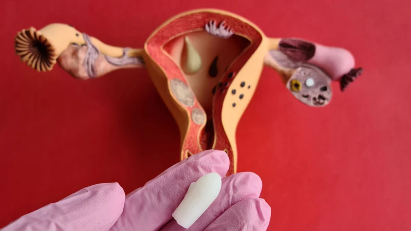 Gợi ý những cách chữa khí hư màu xanh tại nhà an toàn và hiệu quả 5