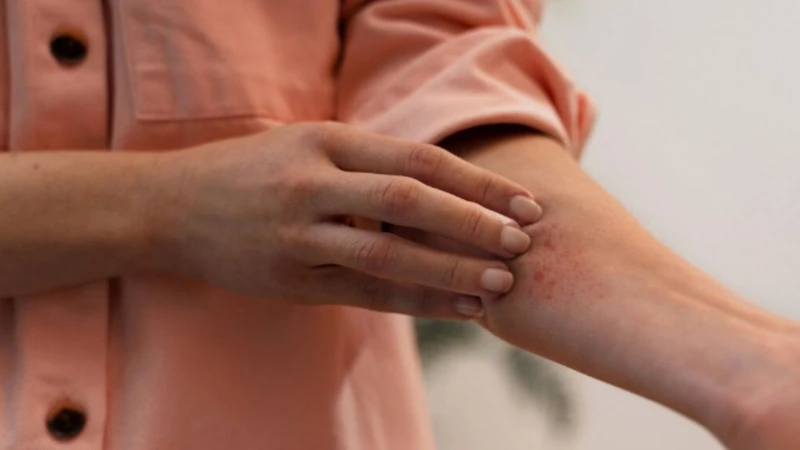 Hắc lào vùng kín​ nữ giới có nguy hiểm không? 3