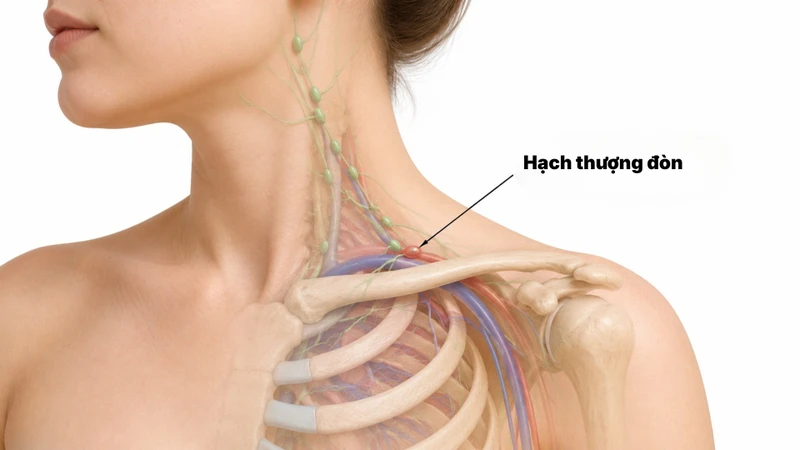 Hạch thượng đòn là một nhóm hạch bạch huyết sâu, nằm trong hố thượng đòn - vùng lõm tự nhiên ngay phía trên xương đòn