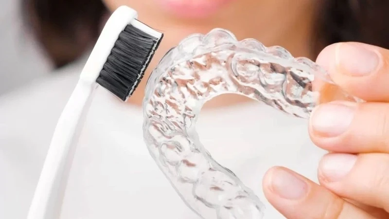 Hàm duy trì trong suốt có ưu điểm là dễ tháo lắp và dễ vệ sinh