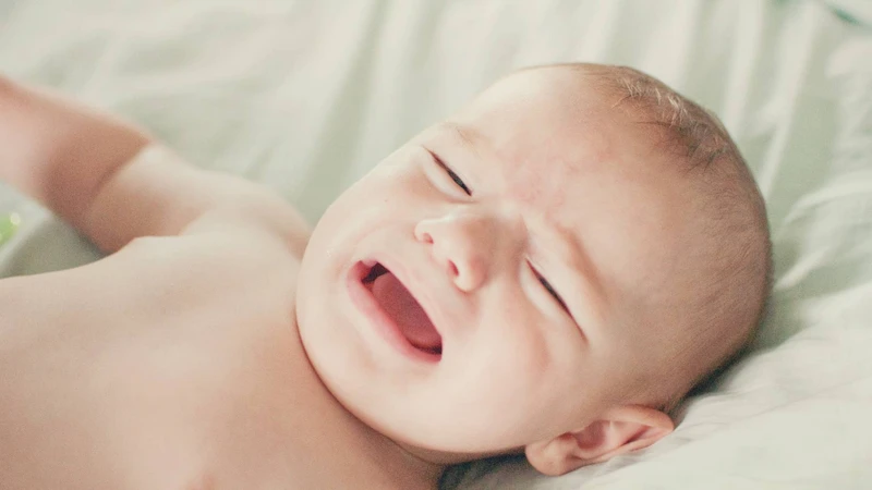 Triệu chứng hăm tã cấp độ 5 là da sưng đỏ, có mủ dễ vỡ, khiến bé đau rát, quấy khóc