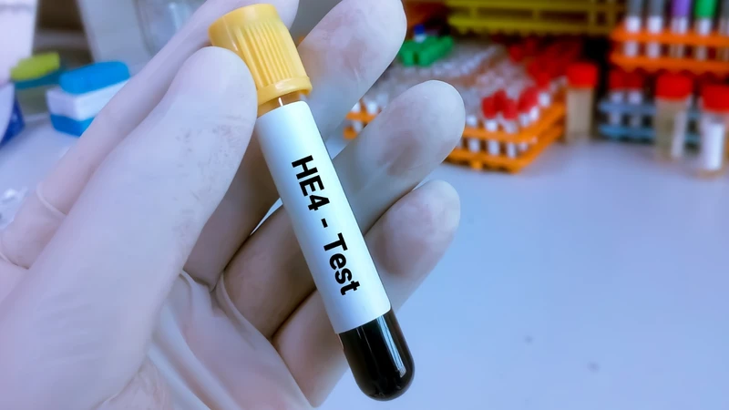 HE4 (Human Epididymis Protein 4) là một glycoprotein thuộc họ protein whey acid, được mã hóa bởi gen WFDC2