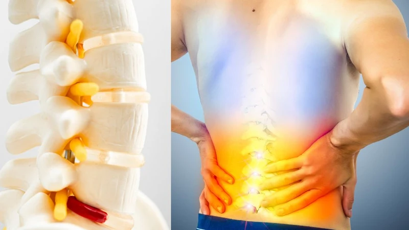 Thoái hoá khớp là bệnh lý rất dễ gặp ở người từ độ trung niên 4