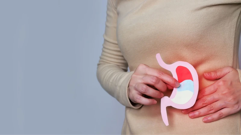 Loét dạ dày lâu ngày thường là nguyên nhân gây hẹp môn vị