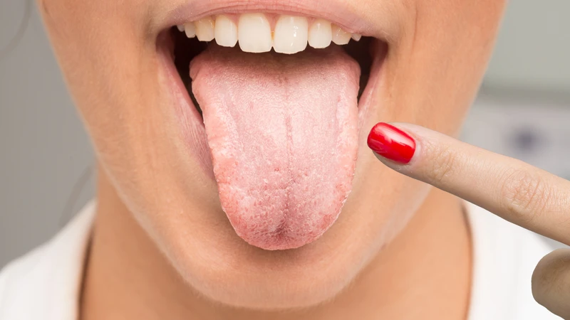 Khi nào cần đi khám nếu nghi ngờ nấm miệng HIV?
