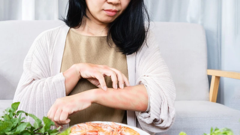 Mề đay ở vùng mặt và cổ thường nổi thành từng mảng, gây ngứa và dễ quan sát bằng mắt thường