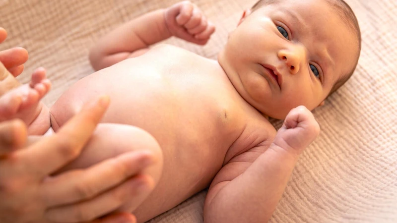 Hình ảnh rốn trẻ sơ sinh bị nhiễm trùng cha mẹ cần lưu ý 1