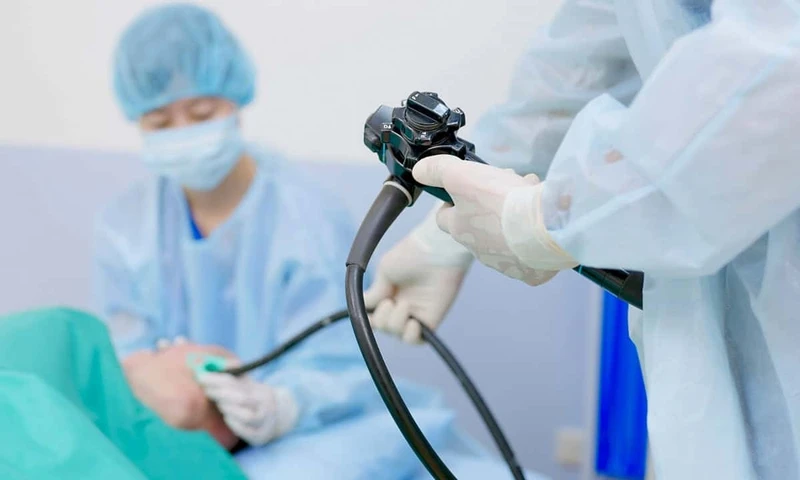 Nội soi dạ dày là phương pháp hiện đại giúp phát hiện những bất thường chuyên sâu trong dạ dày