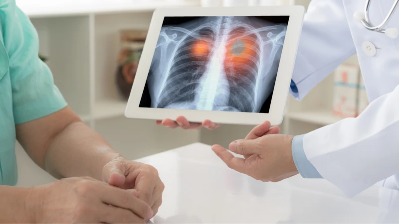 Ho tức ngực có đờm là dấu hiệu của bệnh gì? 3