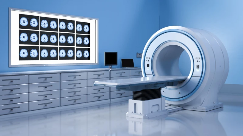 Chụp CT hoặc MRI não giúp phát hiện khối u, chấn thương hoặc tổn thương ở hạch nền và các vùng não liên quan