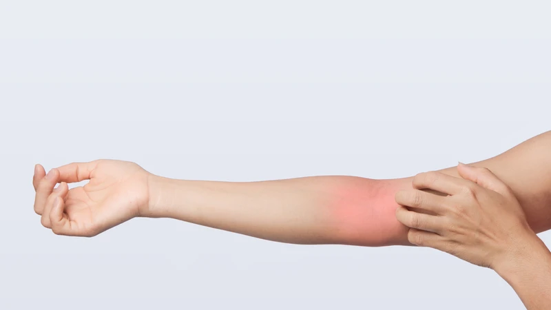 Dây thần kinh quay bị chèn ép có thể gây ra cơn đau âm ỉ, khó chịu