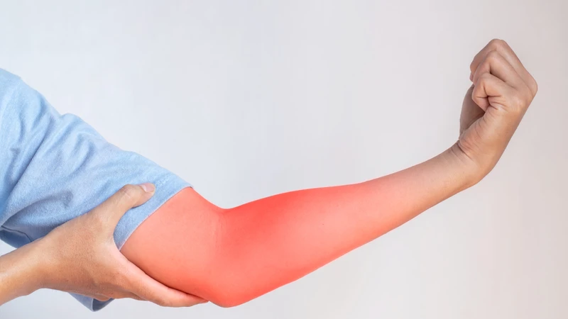 Cơn đau ở cẳng tay là triệu chứng điển hình cần được thăm khám