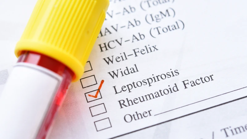 Hội chứng Weil là biến chứng nặng của bệnh Leptospirosis