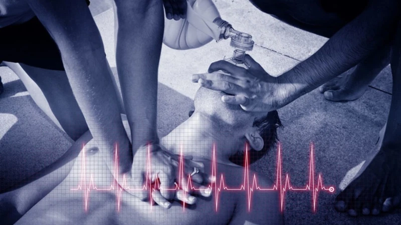 Hình ảnh minh họa quá trình hồi sức tim phổi