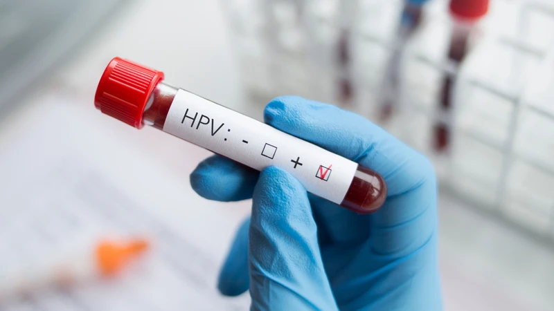 HPV dương tính có sao không? Kết quả xét nghiệm HPV có thể thay đổi theo thời gian không? 1