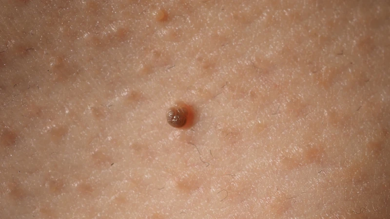 hpv-type-12-co-nguy-hiem-khong-trieu-chung-va-cach-phong-ngua-1.png