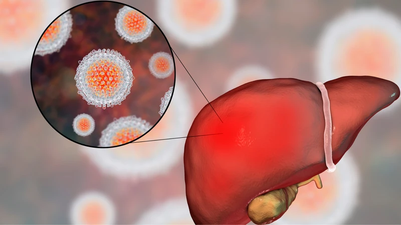 Hướng dẫn chi tiết cách đọc kết quả định lượng virus viêm gan C 4