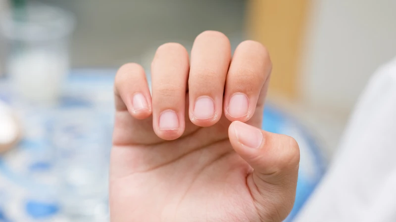 Tóc, da và móng khỏe cần keratin cùng chế độ dinh dưỡng và chăm sóc phù hợp