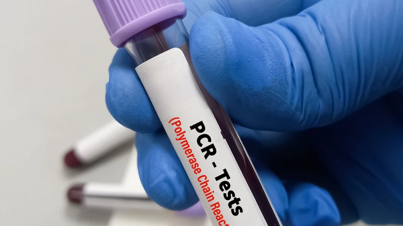 Kết quả xét nghiệm PCR có thể chẩn đoán bệnh gì? Ưu và nhược điểm của xét nghiệm PCR 1