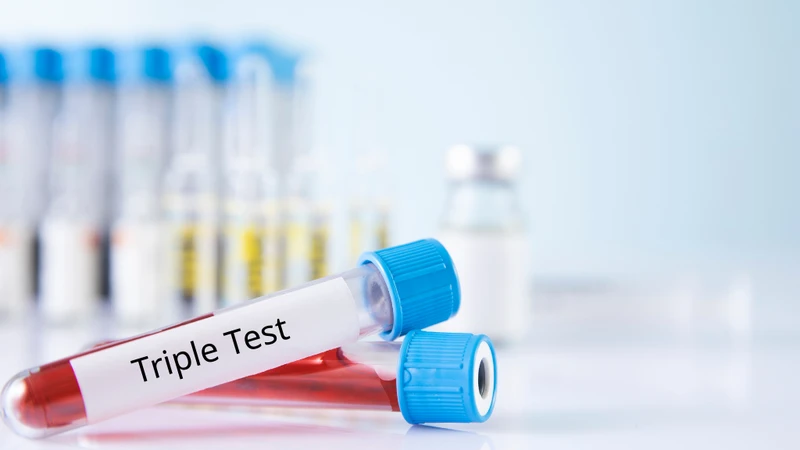 Triple Test chỉ đánh giá một số bất thường nhất định dựa trên các chỉ số sinh hóa