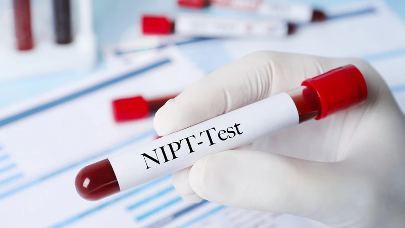 Trong nhiều trường hợp, mẹ bầu được tư vấn làm thêm xét nghiệm NIPT