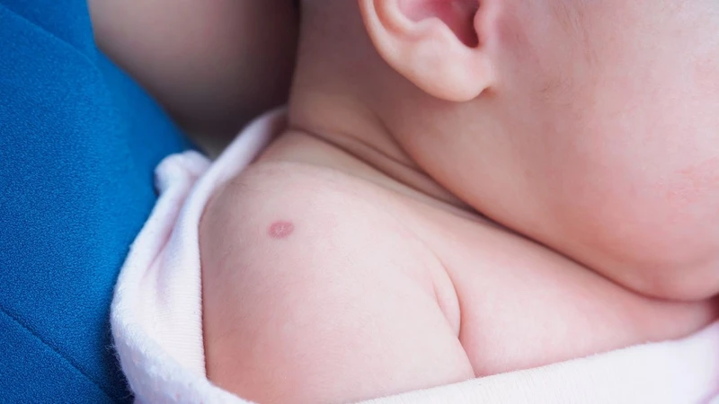 Khạc đờm ra máu: Nguyên nhân, triệu chứng và cách phòng ngừa 5