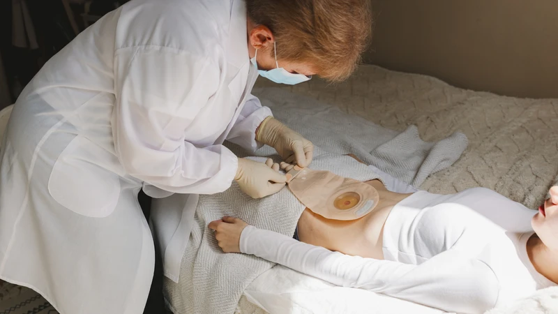 Thời điểm đóng hậu môn nhân tạo được bác sĩ đánh giá theo từng người bệnh