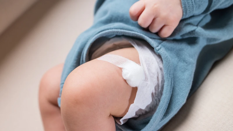 Trẻ dị ứng nghiêm trọng nên tạm hoãn tiêm vắc xin