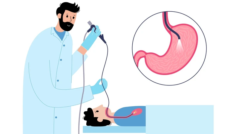 Khoảng cách giữa 2 lần nội soi dạ dày là bao lâu? Lời giải đáp từ phía chuyên gia y tế 4