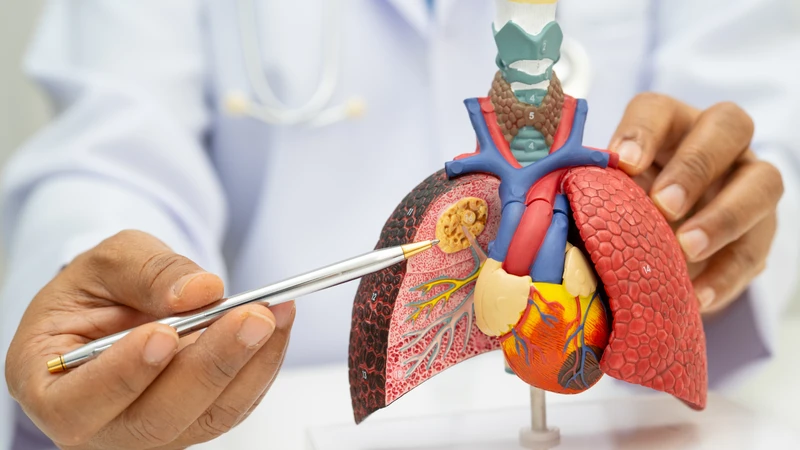 Khối u gan ác tính gây tổn thương nghiêm trọng gan, ảnh hưởng lớn đến tiên lượng nếu chẩn đoán muộn