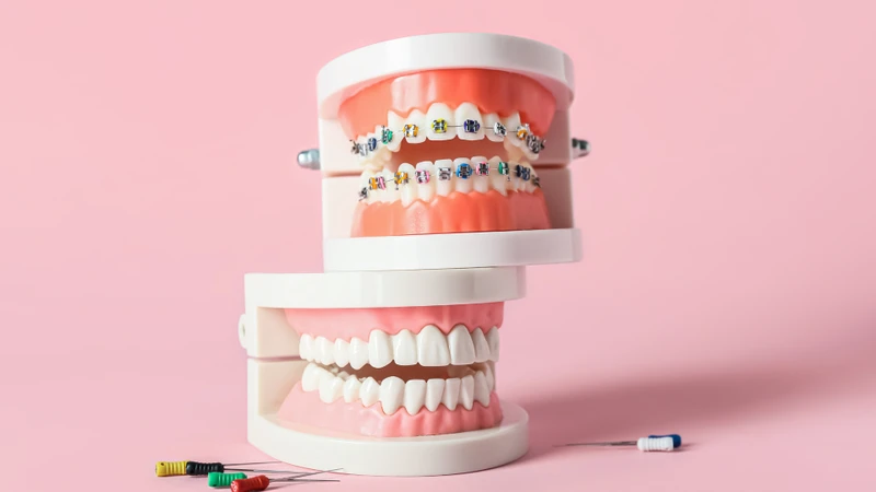 Khớp cắn ngược loại 3: Nhận diện và giải pháp điều trị hiệu quả 2