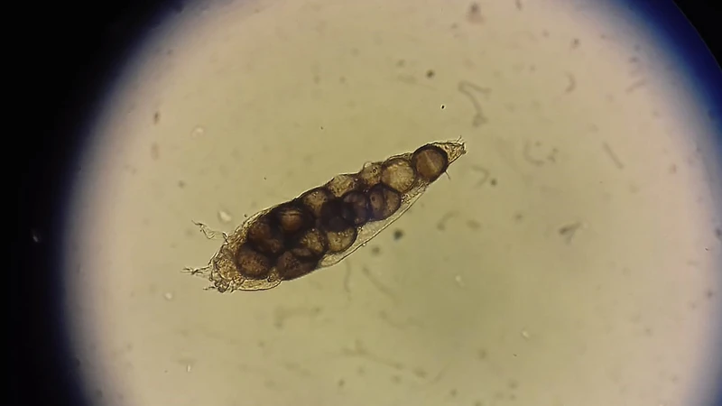 Ký sinh trùng Demodex là một loại vi sinh vật thuộc lớp nhện nhỏ