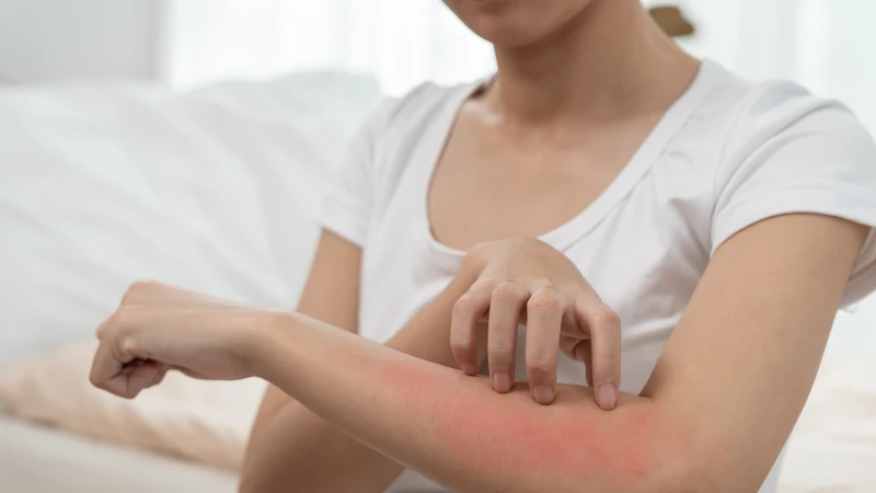 Các vết loét do ký sinh trùng để lại có thể hình thành sẹo