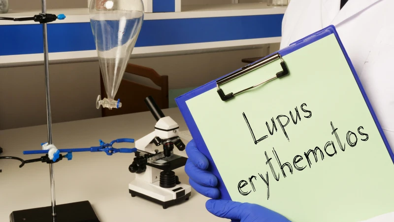 Phản ứng miễn dịch bất thường do lupus ban đỏ cũng có thể khiến lách to