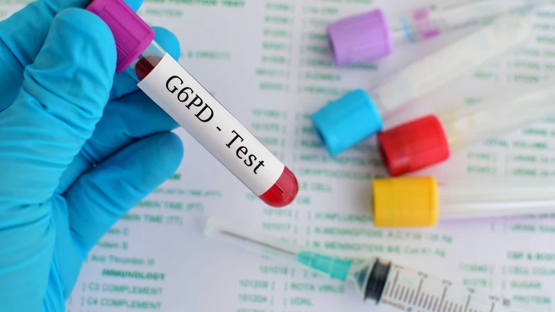 Xét nghiệm máu gót chân giúp phát hiện ra tình trạng thiếu men G6PD