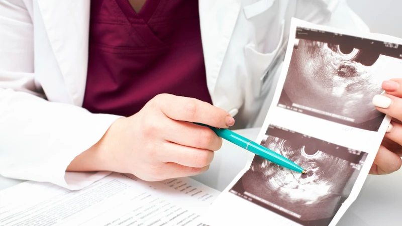 Để biết chính xác làm sao để biết thai nhi mũi cao hay thấp, cha mẹ cần dựa trên kết quả siêu âm