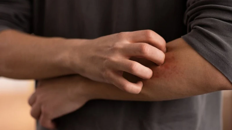 Lang ben hắc lào​ khác nhau ở điểm nào? 1